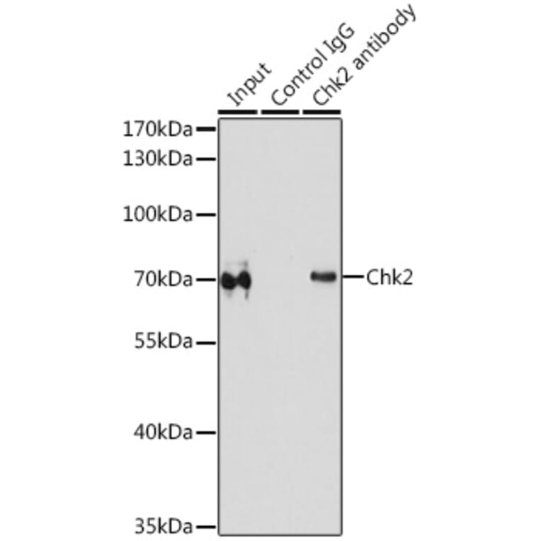 Western Blot - Anti-Chk2 Antibody (A90663) - Antibodies.com