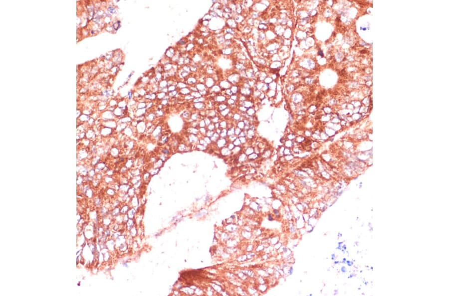 Immunohistochemistry - Anti-FAM98A Antibody (A90664) - Antibodies.com
