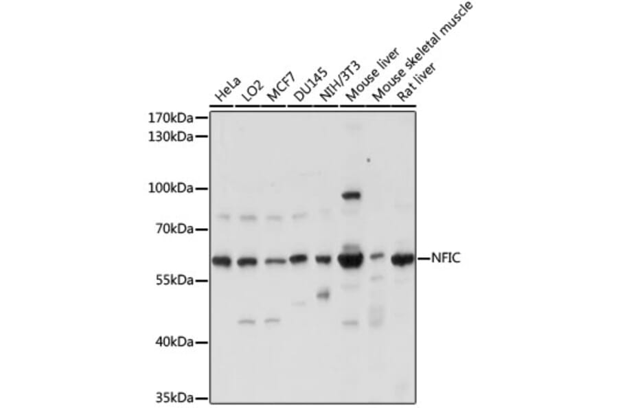 Western Blot - Anti-NFIC/CTF Antibody (A90665) - Antibodies.com