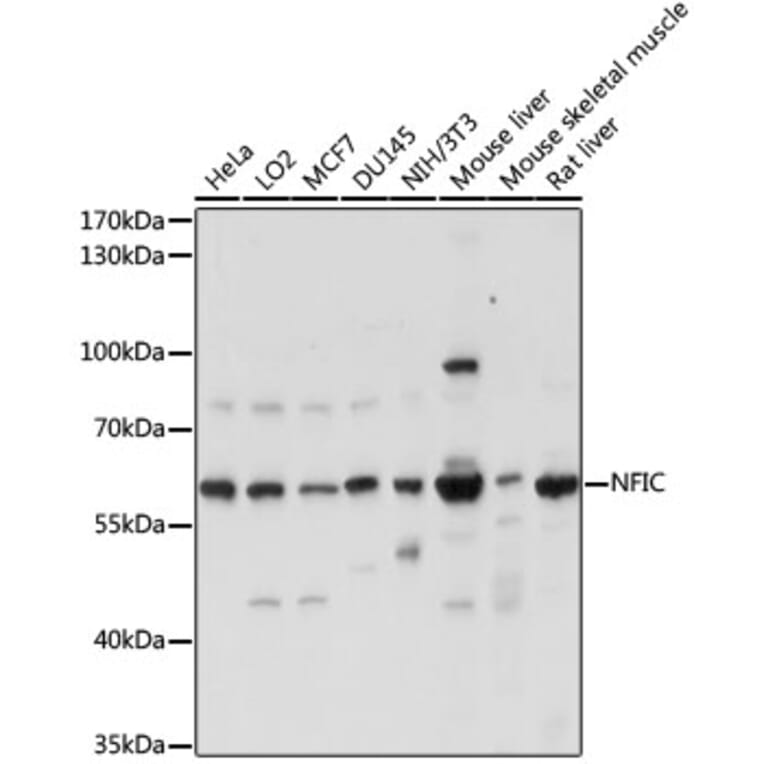 Western Blot - Anti-NFIC/CTF Antibody (A90665) - Antibodies.com