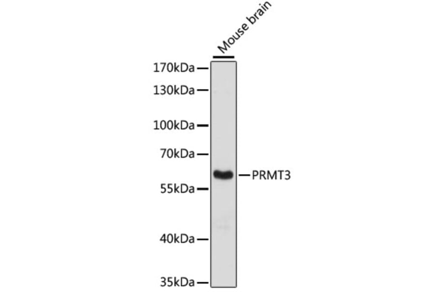 Western Blot - Anti-PRMT3 Antibody (A90666) - Antibodies.com
