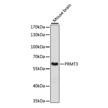 Western Blot - Anti-PRMT3 Antibody (A90666) - Antibodies.com