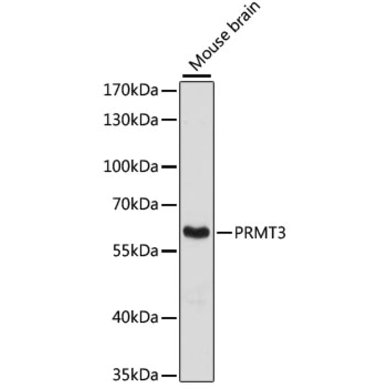 Western Blot - Anti-PRMT3 Antibody (A90666) - Antibodies.com