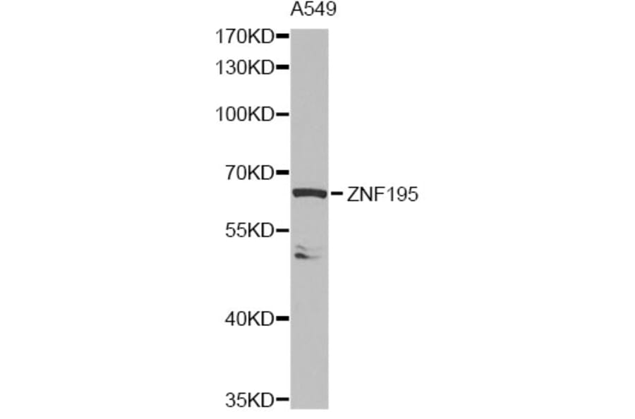 Western Blot - Anti-ZNF195 Antibody (A14071) - Antibodies.com