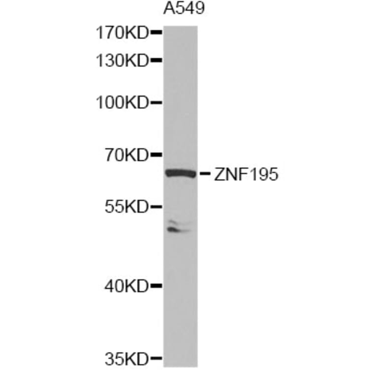 Western Blot - Anti-ZNF195 Antibody (A14071) - Antibodies.com
