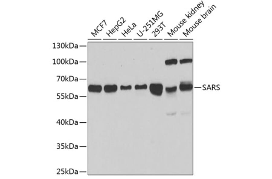 Western Blot - Anti-Seryl-tRNA synthetase/SERS Antibody (A90668) - Antibodies.com