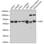 Western Blot - Anti-Seryl-tRNA synthetase/SERS Antibody (A90668) - Antibodies.com