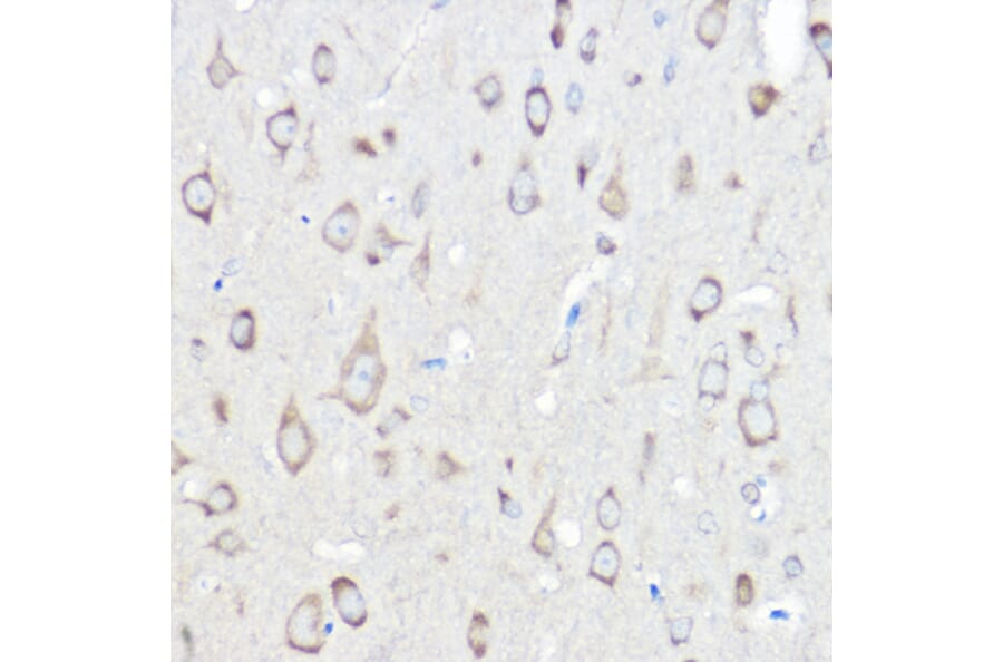 Immunohistochemistry - Anti-Seryl-tRNA synthetase/SERS Antibody (A90668) - Antibodies.com