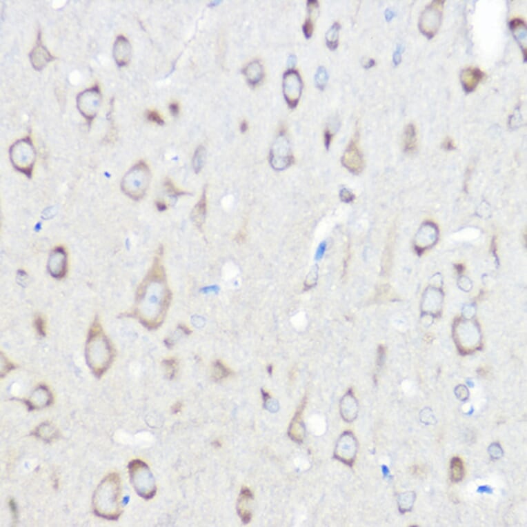 Immunohistochemistry - Anti-Seryl-tRNA synthetase/SERS Antibody (A90668) - Antibodies.com