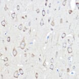 Immunohistochemistry - Anti-Seryl-tRNA synthetase/SERS Antibody (A90668) - Antibodies.com