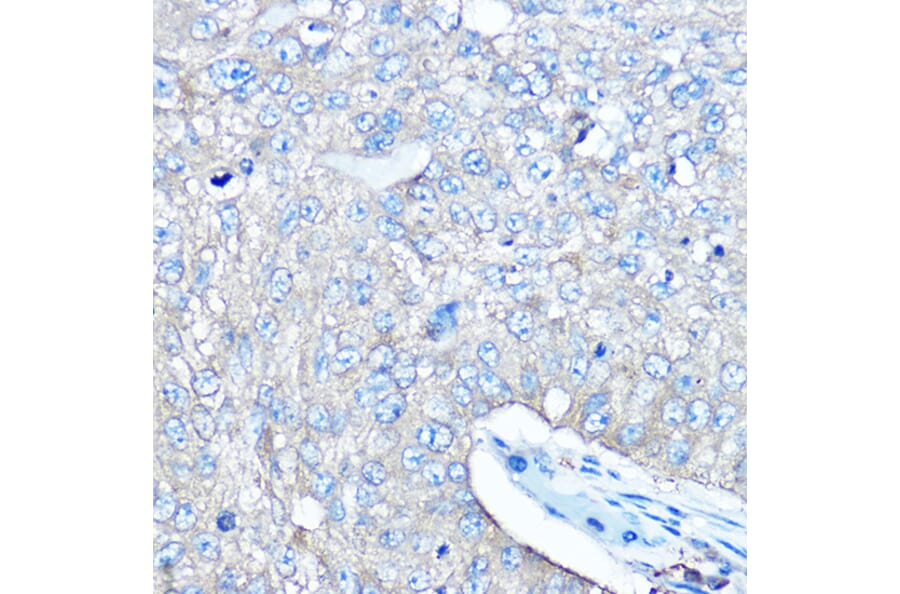 Immunohistochemistry - Anti-Seryl-tRNA synthetase/SERS Antibody (A90668) - Antibodies.com