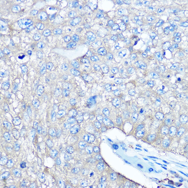 Immunohistochemistry - Anti-Seryl-tRNA synthetase/SERS Antibody (A90668) - Antibodies.com