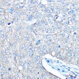 Immunohistochemistry - Anti-Seryl-tRNA synthetase/SERS Antibody (A90668) - Antibodies.com