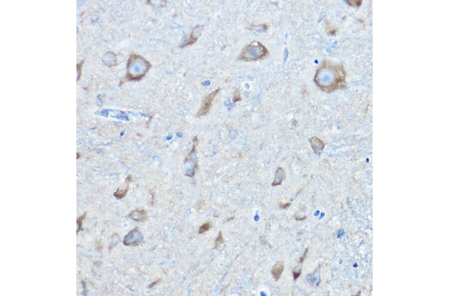 Immunohistochemistry - Anti-Seryl-tRNA synthetase/SERS Antibody (A90668) - Antibodies.com