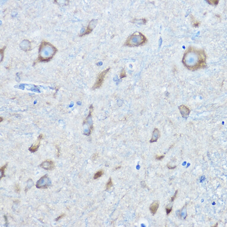 Immunohistochemistry - Anti-Seryl-tRNA synthetase/SERS Antibody (A90668) - Antibodies.com