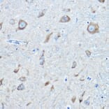 Immunohistochemistry - Anti-Seryl-tRNA synthetase/SERS Antibody (A90668) - Antibodies.com