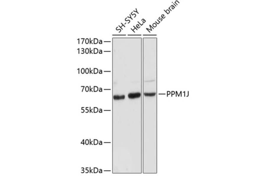Western Blot - Anti-PPM1J Antibody (A90669) - Antibodies.com