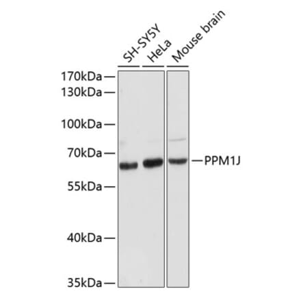 Western Blot - Anti-PPM1J Antibody (A90669) - Antibodies.com