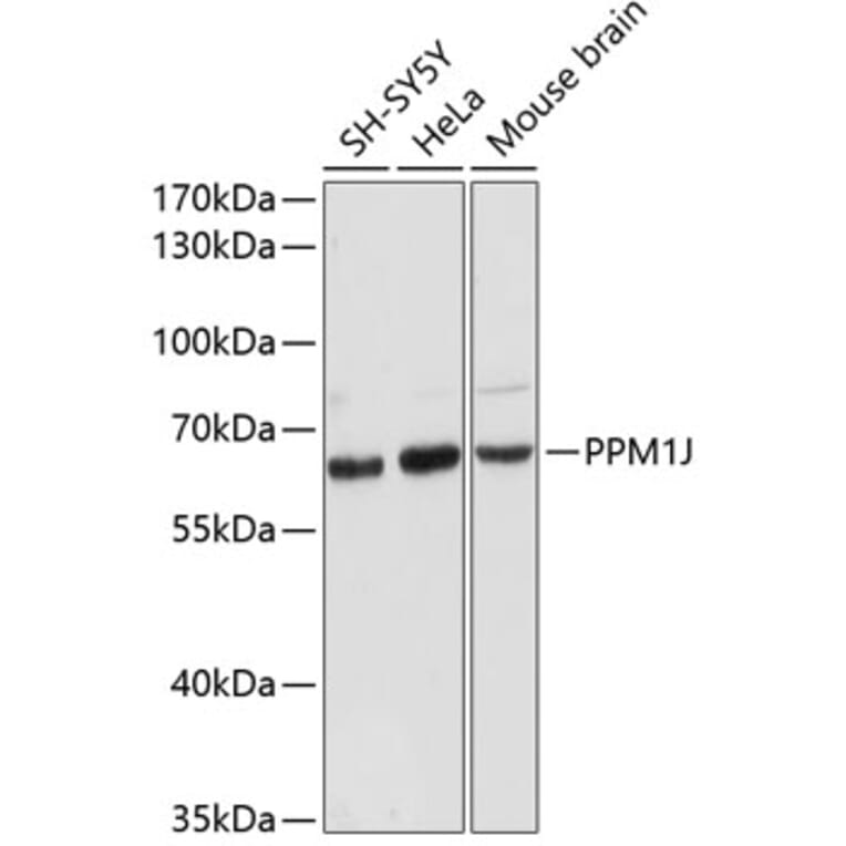 Western Blot - Anti-PPM1J Antibody (A90669) - Antibodies.com