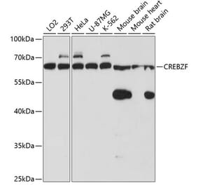 Western Blot - Anti-Zhangfei Antibody (A90670) - Antibodies.com