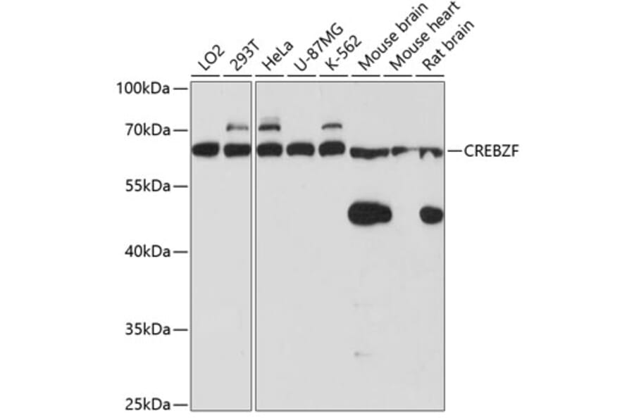 Western Blot - Anti-Zhangfei Antibody (A90670) - Antibodies.com
