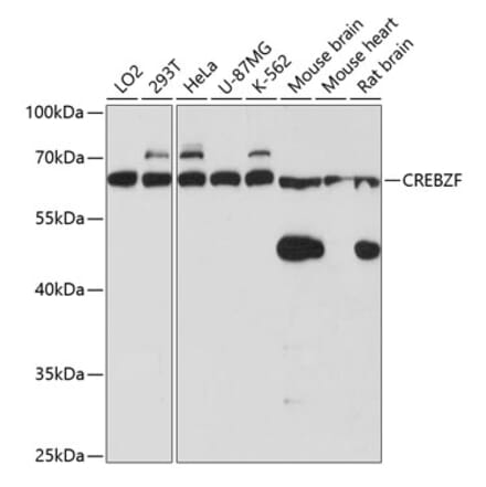 Western Blot - Anti-Zhangfei Antibody (A90670) - Antibodies.com