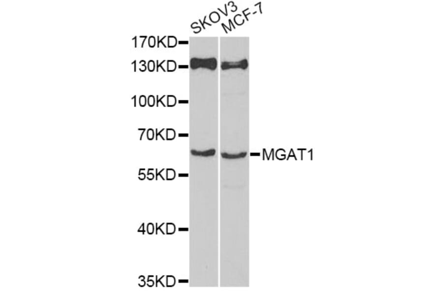 Western Blot - Anti-MGAT1 Antibody (A12459) - Antibodies.com