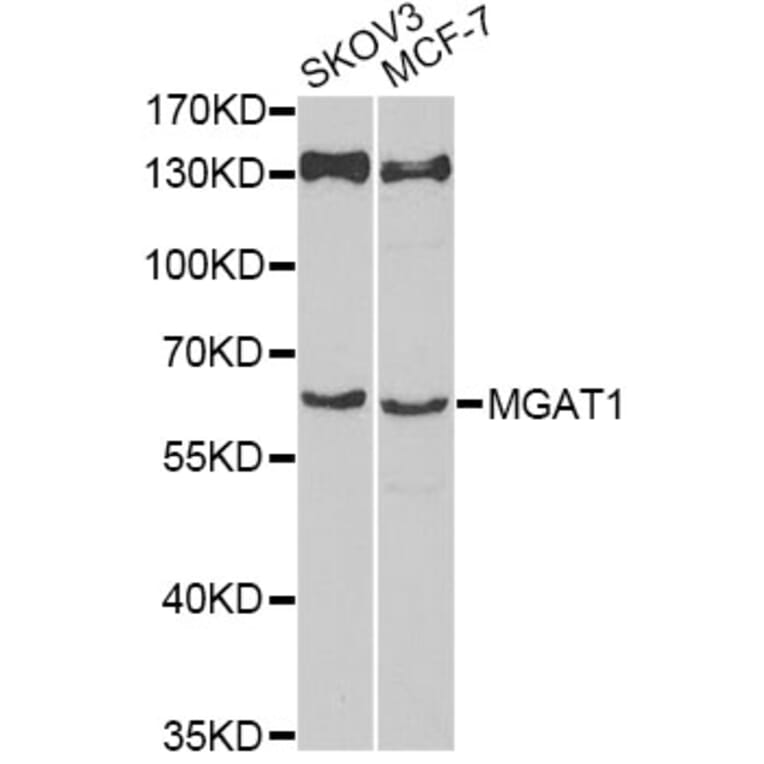 Western Blot - Anti-MGAT1 Antibody (A12459) - Antibodies.com