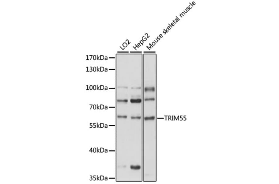 Western Blot - Anti-MURF2 Antibody (A90673) - Antibodies.com