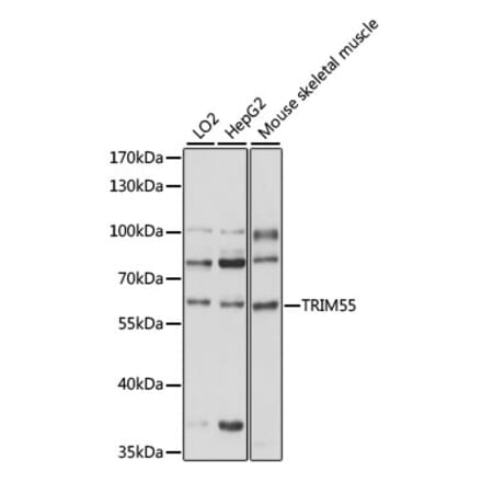 Western Blot - Anti-MURF2 Antibody (A90673) - Antibodies.com