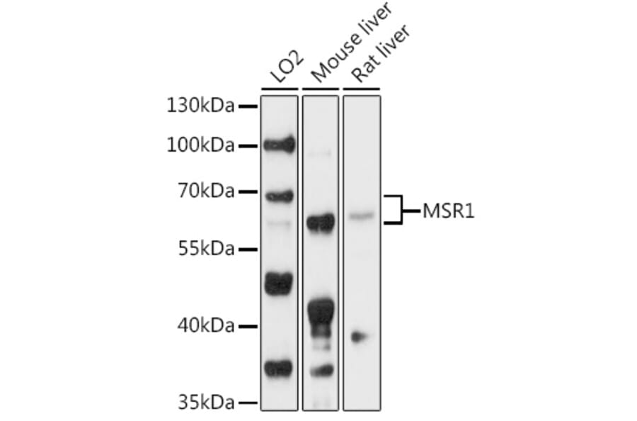 Western Blot - Anti-CD204 Antibody (A90674) - Antibodies.com