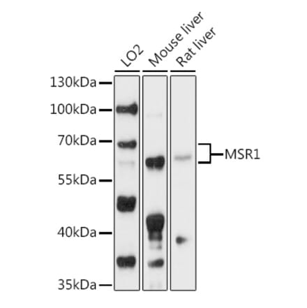 Western Blot - Anti-CD204 Antibody (A90674) - Antibodies.com