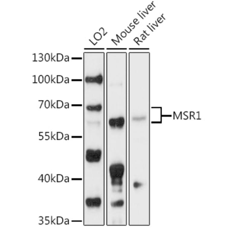 Western Blot - Anti-CD204 Antibody (A90674) - Antibodies.com