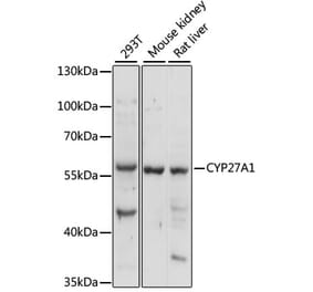 Western Blot - Anti-CYP27A1 Antibody (A90675) - Antibodies.com