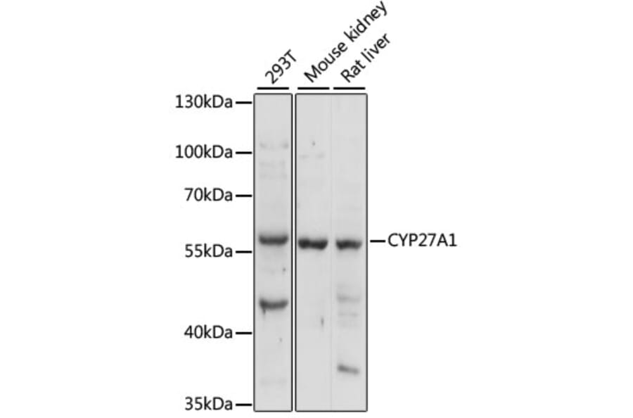Western Blot - Anti-CYP27A1 Antibody (A90675) - Antibodies.com