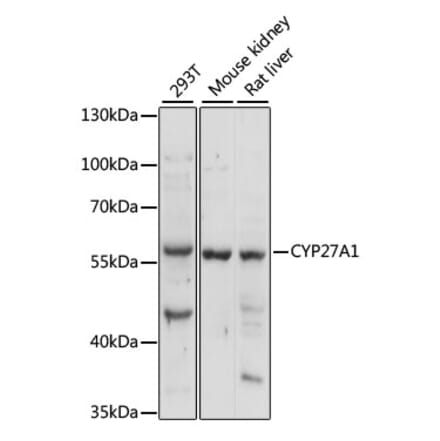 Western Blot - Anti-CYP27A1 Antibody (A90675) - Antibodies.com