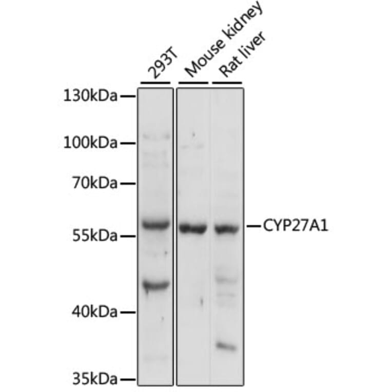 Western Blot - Anti-CYP27A1 Antibody (A90675) - Antibodies.com