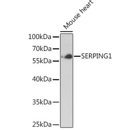 Western Blot - Anti-SERPING1 Antibody (A90676) - Antibodies.com