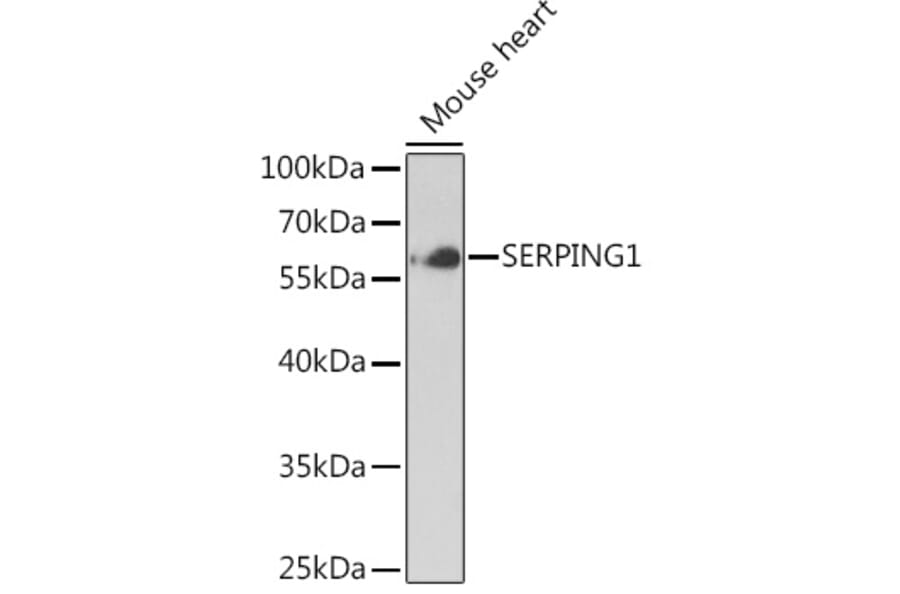 Western Blot - Anti-SERPING1 Antibody (A90676) - Antibodies.com