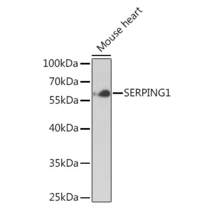 Western Blot - Anti-SERPING1 Antibody (A90676) - Antibodies.com