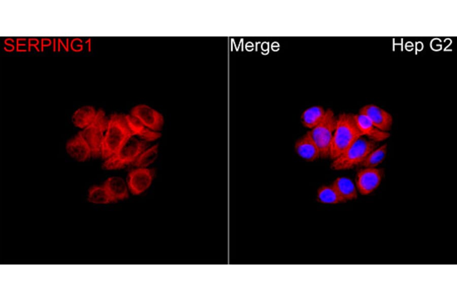 Immunofluorescence - Anti-SERPING1 Antibody (A90676) - Antibodies.com