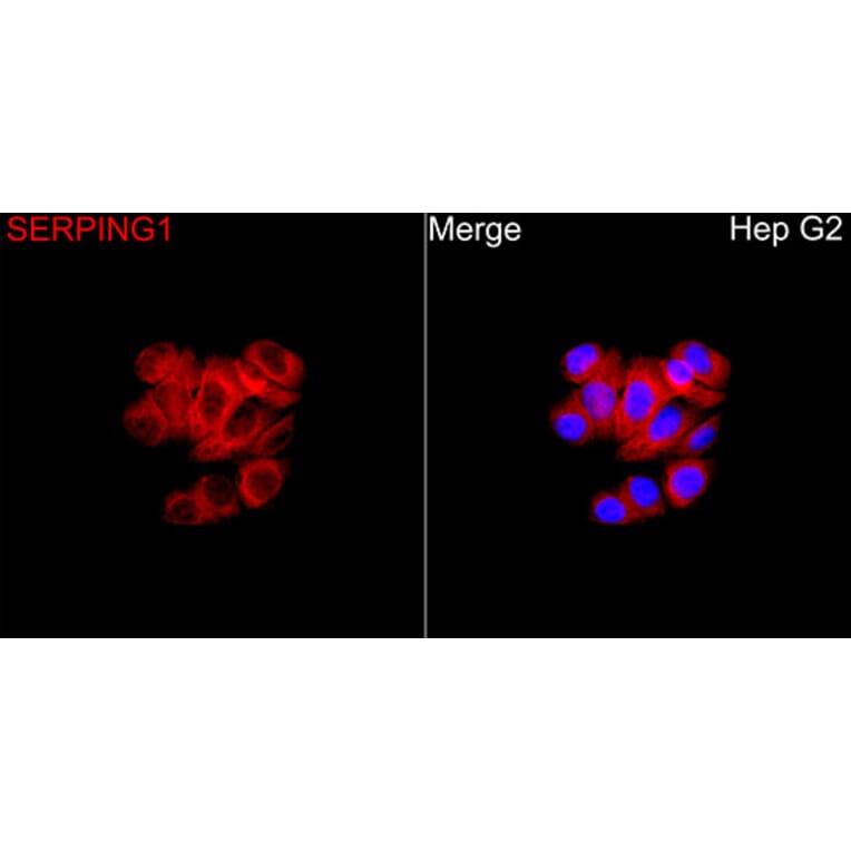 Immunofluorescence - Anti-SERPING1 Antibody (A90676) - Antibodies.com