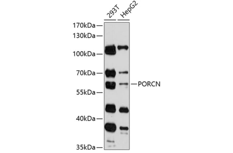 Western Blot - Anti-PORCN Antibody (A90677) - Antibodies.com