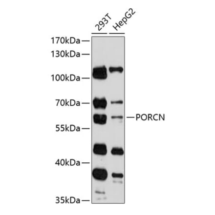 Western Blot - Anti-PORCN Antibody (A90677) - Antibodies.com