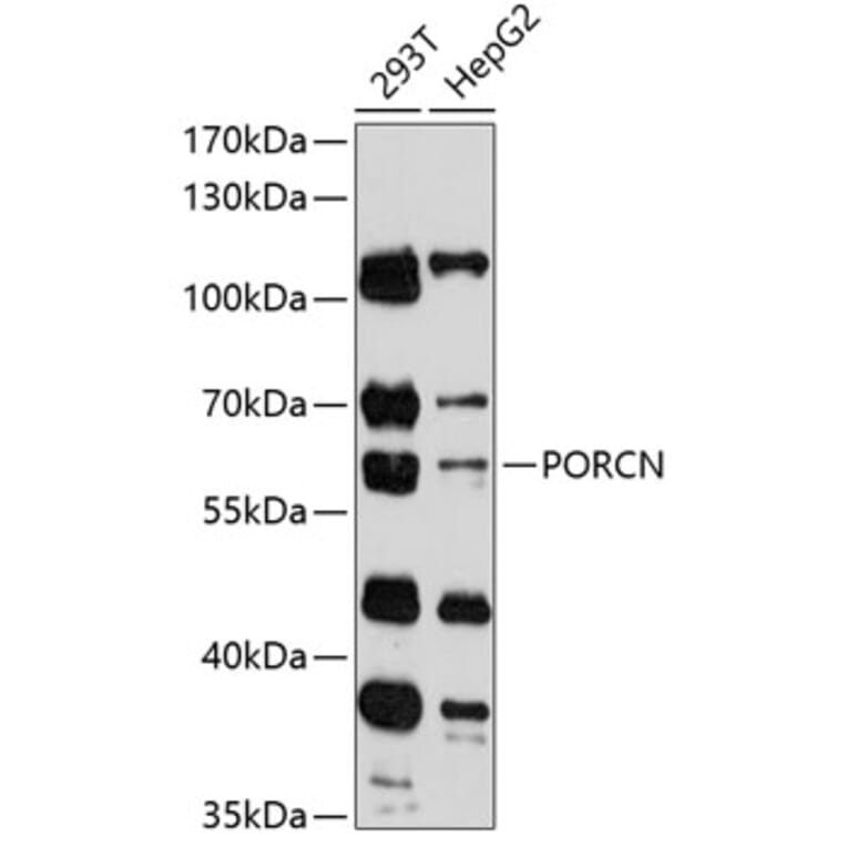 Western Blot - Anti-PORCN Antibody (A90677) - Antibodies.com