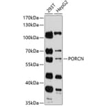 Western Blot - Anti-PORCN Antibody (A90677) - Antibodies.com