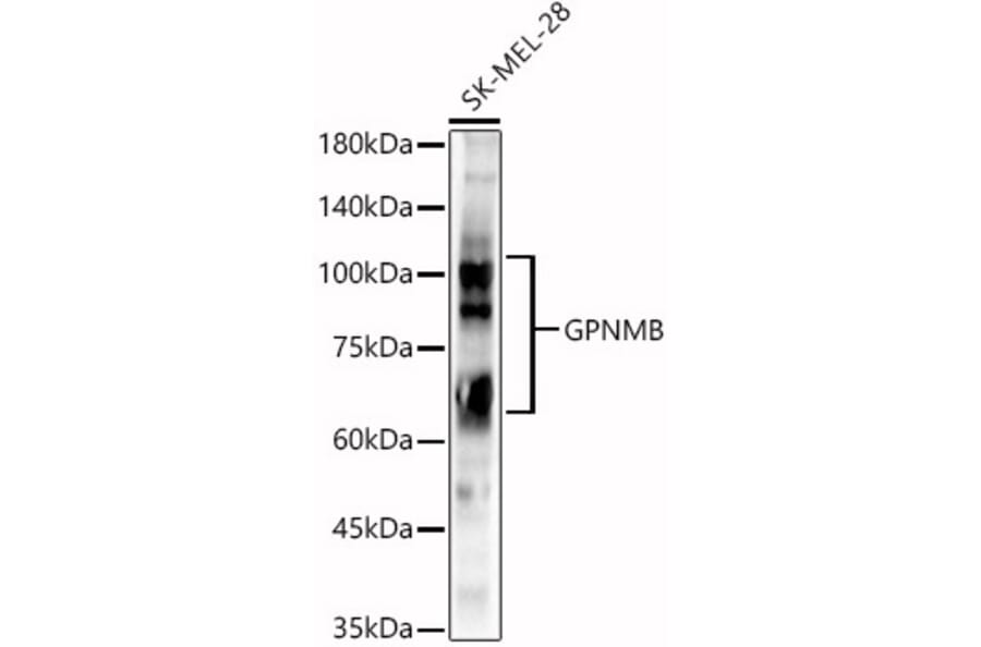 Western Blot - Anti-GPNMB Antibody (A90678) - Antibodies.com