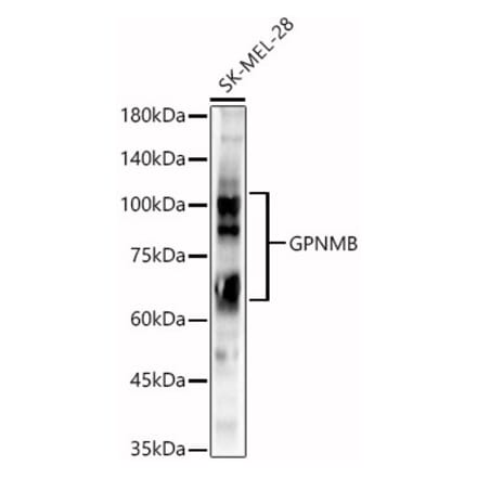 Western Blot - Anti-GPNMB Antibody (A90678) - Antibodies.com