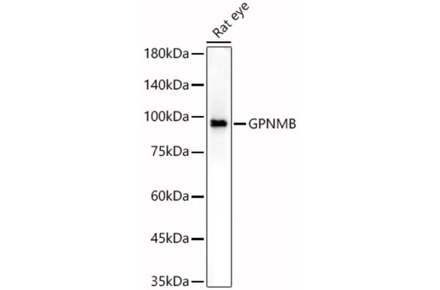 Western Blot - Anti-GPNMB Antibody (A90678) - Antibodies.com