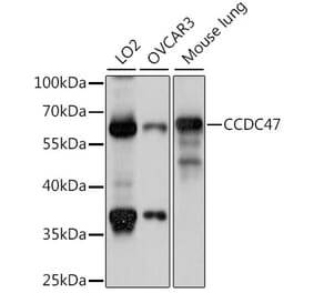 Western Blot - Anti-CCDC47 Antibody (A90679) - Antibodies.com